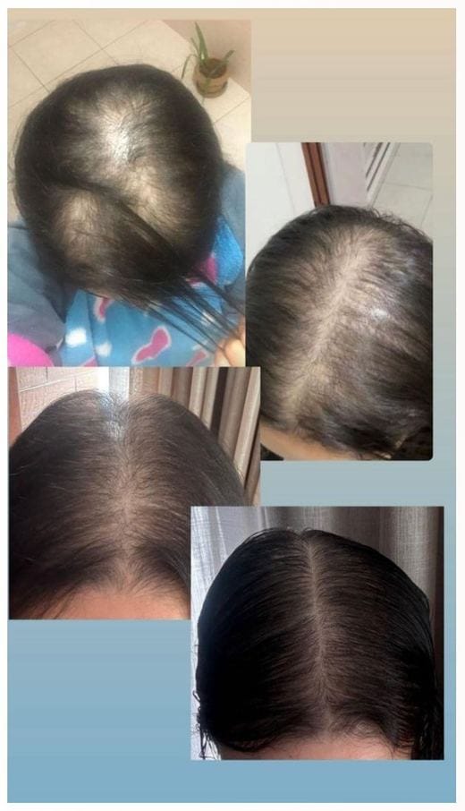 Antes e depois - Adriana Souza