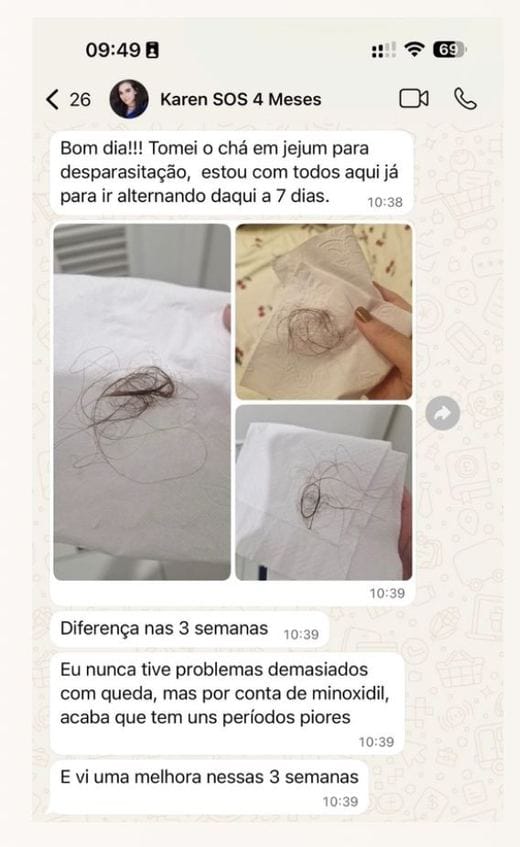 Antes e depois - Karen