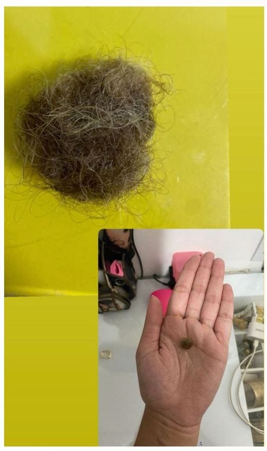 Antes e depois - Vitoria Salazar